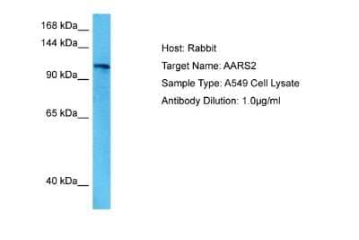 Western Blot: AARS2 Antibody [NBP2-86932]