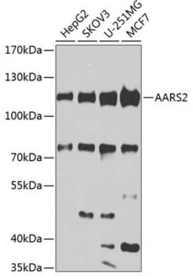 Western Blot: AARS2 AntibodyBSA Free [NBP2-92487]