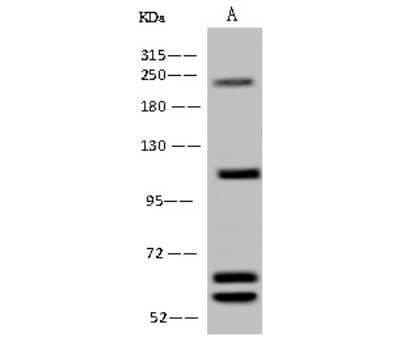 Western Blot: AARS2 Antibody [NBP2-98582]