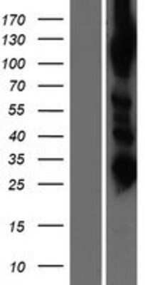 Western Blot: AARS2 Overexpression Lysate [NBP2-06620]