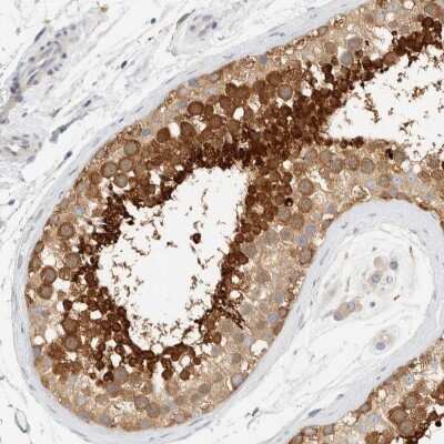 Immunohistochemistry-Paraffin: AARSD1 Antibody [NBP1-81143]