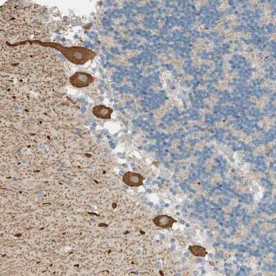 Immunohistochemistry-Paraffin: PTGES3L-AARSD1 Antibody [NBP1-81145]