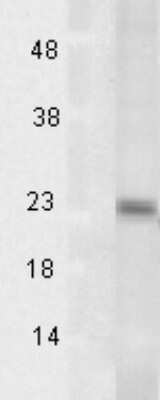 Western Blot: AARSD1 Antibody (Tsp232A) [NBP2-12887]