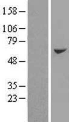 Western Blot: AARSD1 Overexpression Lysate [NBL1-07166]