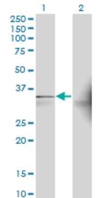 Western Blot: AASD-PPT Antibody (2C12) [H00060496-M01]