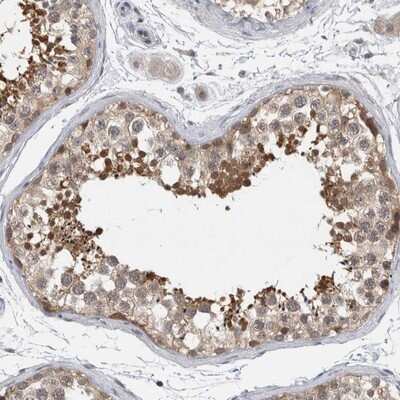 Immunohistochemistry-Paraffin: AASD-PPT Antibody [NBP1-89322]