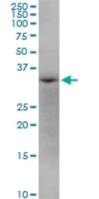 Western Blot: AASD-PPT Antibody [H00060496-B01P]
