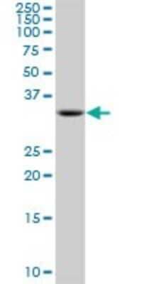 Western Blot: AASD-PPT Antibody [H00060496-B01P]