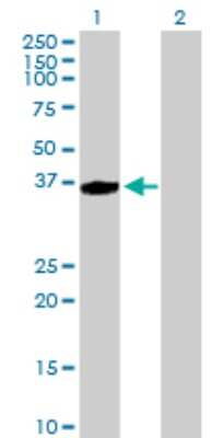 Western Blot: AASD-PPT Antibody [H00060496-B01P]