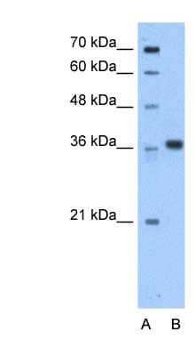 Western Blot: AASD-PPT Antibody [NBP1-54977]