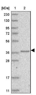 Western Blot: AASD-PPT Antibody [NBP1-89322]