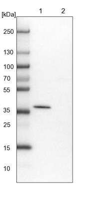 Western Blot: AASD-PPT Antibody [NBP1-89322]