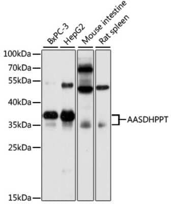 Western Blot: AASD-PPT AntibodyAzide and BSA Free [NBP2-92449]