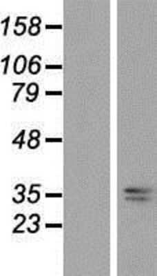 Western Blot: AASD-PPT Overexpression Lysate [NBP2-07179]