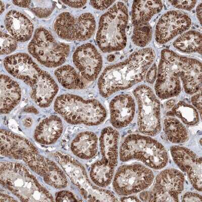 Immunohistochemistry: AASDH Antibody [NBP2-32667]