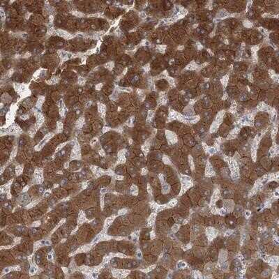 Immunohistochemistry-Paraffin: AASDH Antibody [NBP1-89266]