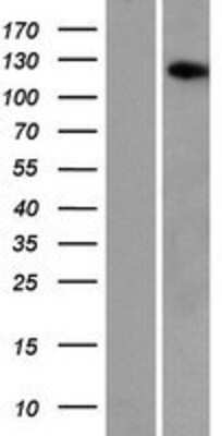 Western Blot: AASDH Overexpression Lysate [NBP2-04884]