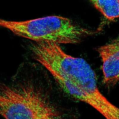 Immunocytochemistry/ Immunofluorescence: AASS Antibody [NBP1-82831]