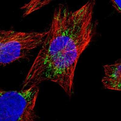 Immunocytochemistry/ Immunofluorescence: AASS Antibody [NBP1-82832]