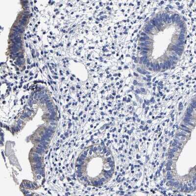 Immunohistochemistry-Paraffin: AASS Antibody [NBP1-82831]