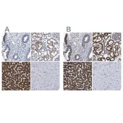 Immunohistochemistry-Paraffin: AASS Antibody [NBP1-82831]