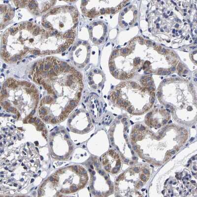 Immunohistochemistry-Paraffin: AASS Antibody [NBP1-82831]