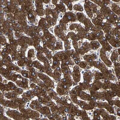 Immunohistochemistry-Paraffin: AASS Antibody [NBP1-82831]