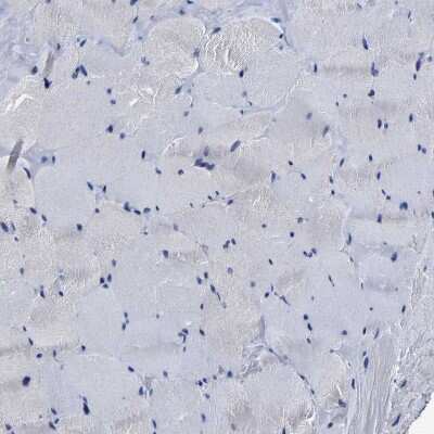 Immunohistochemistry-Paraffin: AASS Antibody [NBP1-82831]