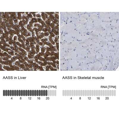 Immunohistochemistry-Paraffin: AASS Antibody [NBP1-82831]