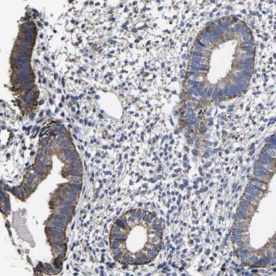 Immunohistochemistry-Paraffin: AASS Antibody [NBP1-82832]