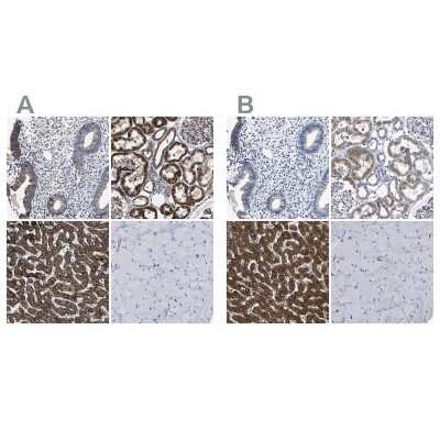 Immunohistochemistry-Paraffin: AASS Antibody [NBP1-82832]