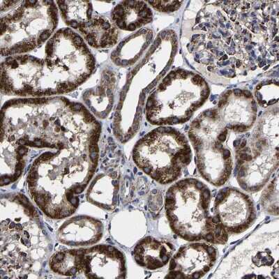 Immunohistochemistry-Paraffin: AASS Antibody [NBP1-82832]