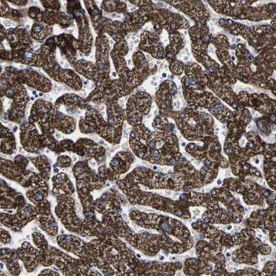 Immunohistochemistry-Paraffin: AASS Antibody [NBP1-82832]