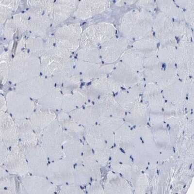 Immunohistochemistry-Paraffin: AASS Antibody [NBP1-82832]