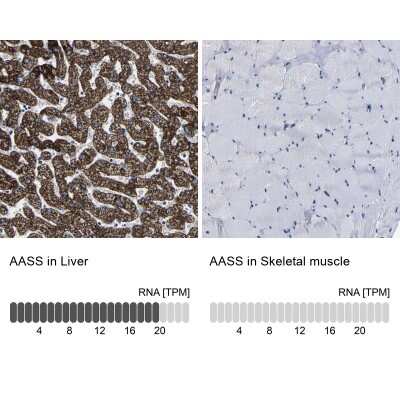Immunohistochemistry-Paraffin: AASS Antibody [NBP1-82832]