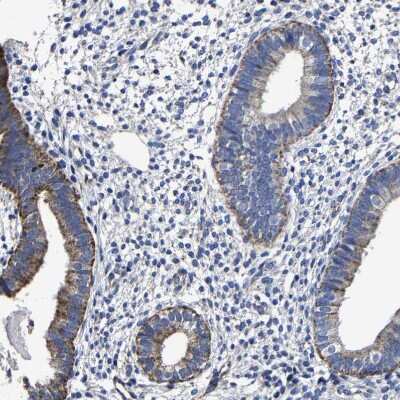 Immunohistochemistry-Paraffin: AASS Antibody [NBP1-82833]