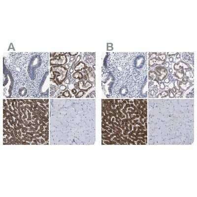 Immunohistochemistry-Paraffin: AASS Antibody [NBP1-82833]