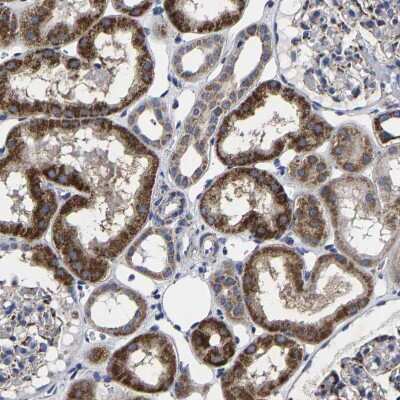 Immunohistochemistry-Paraffin: AASS Antibody [NBP1-82833]