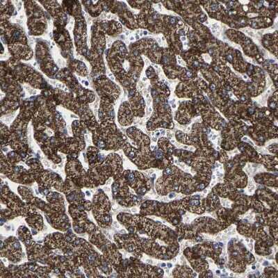 Immunohistochemistry-Paraffin: AASS Antibody [NBP1-82833]