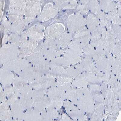 Immunohistochemistry-Paraffin: AASS Antibody [NBP1-82833]