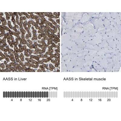 Immunohistochemistry-Paraffin: AASS Antibody [NBP1-82833]