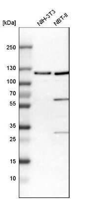 Western Blot: AASS Antibody [NBP1-82831]