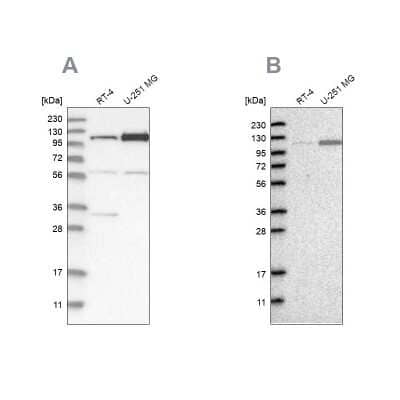 Western Blot: AASS Antibody [NBP1-82831]