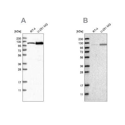 Western Blot: AASS Antibody [NBP1-82832]