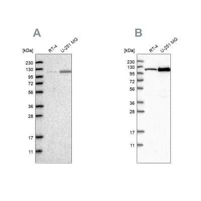 Western Blot: AASS Antibody [NBP1-82833]