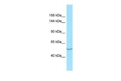 Western Blot: AASS Antibody [NBP2-86933]