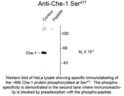 Western Blot: AATF [p Ser477] Antibody [NBP2-29517]