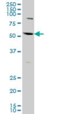 Western Blot: AATF Antibody (2H6) [H00026574-M09]