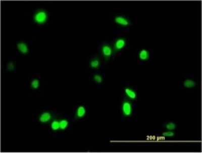 Immunocytochemistry/ Immunofluorescence: AATF Antibody (3C7) [H00026574-M04]