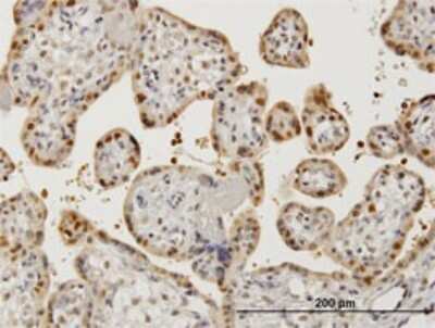 Immunohistochemistry-Paraffin: AATF Antibody (3C7) [H00026574-M04]